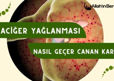 Karaciğer Yağlanması Nasıl Geçer Canan Karatay