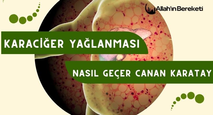 Karaciğer Yağlanması Nasıl Geçer Canan Karatay