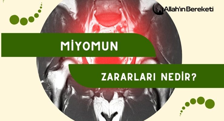 Miyomun Zararları Nedir