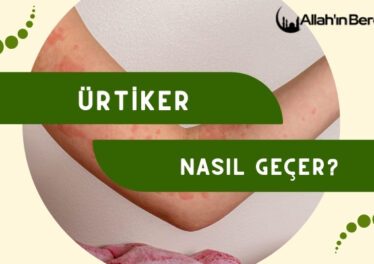 Ürtiker Nasıl Geçer