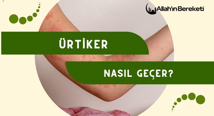 Ürtiker Nasıl Geçer