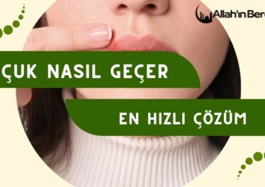 Uçuk Nasıl Geçer