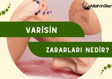 Varisin Zararları Nedir