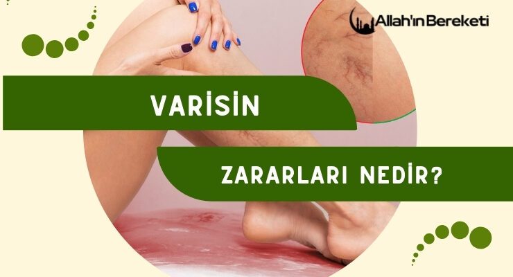 Varisin Zararları Nedir