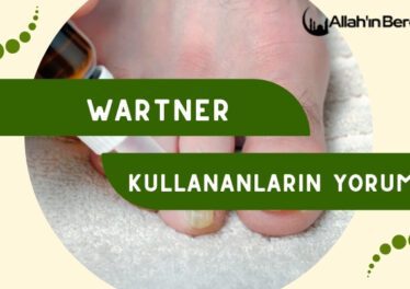 Wartner Kullananların Yorumları