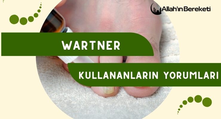 Wartner Kullananların Yorumları